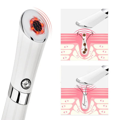 Eye Massager - Emiratec